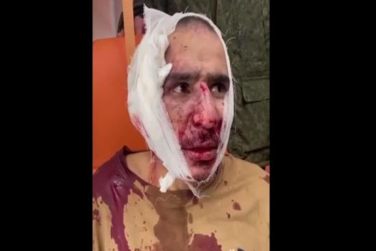 Підозрюваному в нападі на “Крокус Сіті” після затримання відрізали вухо — російський “воєнблогер” (GlavPost)