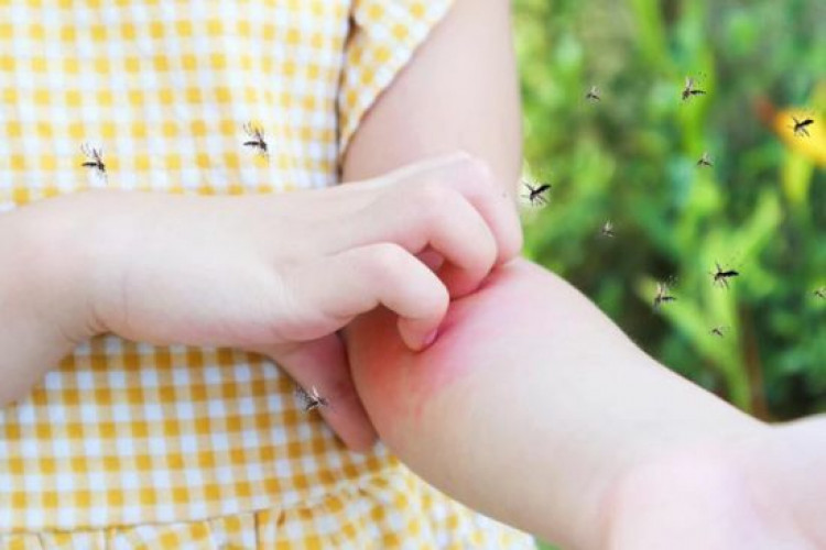 Сезон комарів: яку групу крові "полюбляють кровопивці" та як боротися з наслідками укусів (GlavPost)