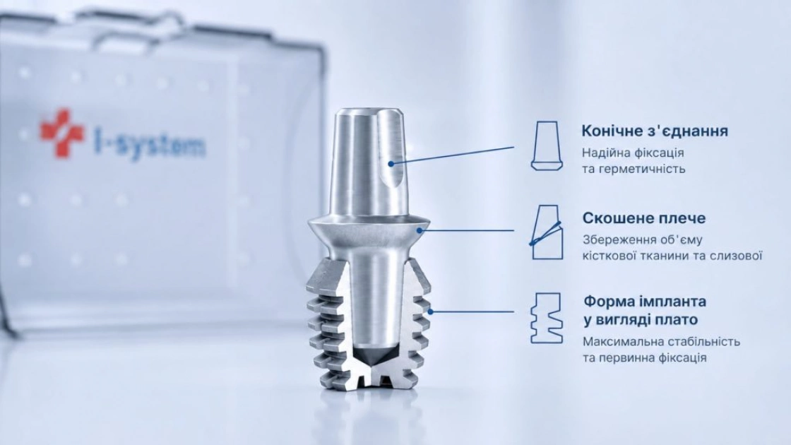 Швейцарські імпланти I-system / Джерело: https://osadchy.doctor/